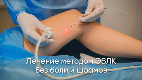 Лазерное лечение варикозной болезни в Барнауле